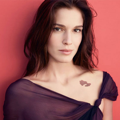 Hemangiomas TReatment in Dubai